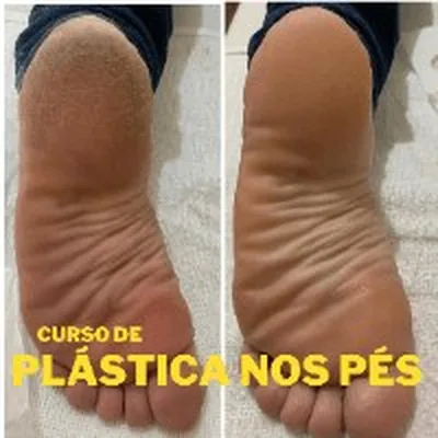 Capa de Curso Plástica nos Pés