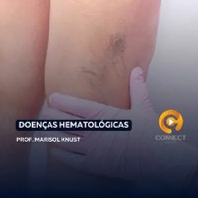 Capa de Doenças Hematológicas - Cefae Connect